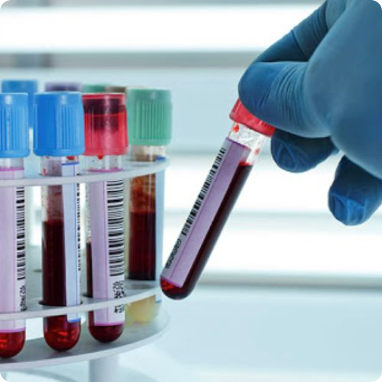 Diagnostic Test